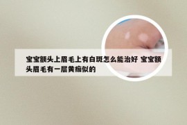 宝宝额头上眉毛上有白斑怎么能治好 宝宝额头眉毛有一层黄痂似的