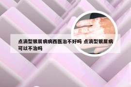 点滴型银屑病病西医治不好吗 点滴型银屑病可以不治吗