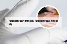 掌跖脓疱病泡要挑破吗 掌跖脓疱病可以挑破吗