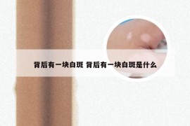 背后有一块白斑 背后有一块白斑是什么