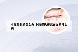 小孩得头癣怎么办 小孩得头癣怎么办用什么药