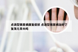 点滴型银屑病康复症状 点滴型银屑病治好了复发几率大吗