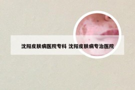 沈阳皮肤病医院专科 沈阳皮肤病专治医院