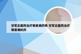 空军总医院治疗银屑病药物 空军总医院治疗银屑病的药