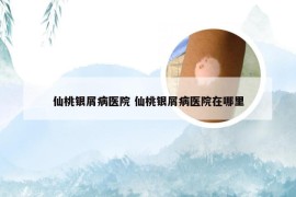 仙桃银屑病医院 仙桃银屑病医院在哪里