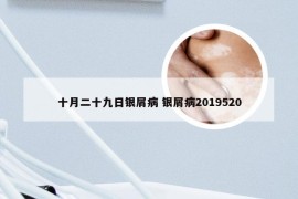 十月二十九日银屑病 银屑病2019520