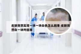皮肤突然出现一块一块白色怎么回事 皮肤突然白一块咋回事