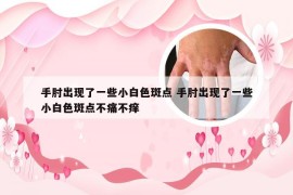 手肘出现了一些小白色斑点 手肘出现了一些小白色斑点不痛不痒