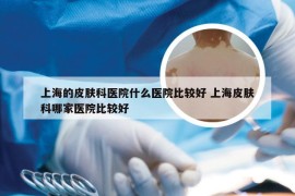 上海的皮肤科医院什么医院比较好 上海皮肤科哪家医院比较好