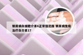 银屑病白细胞介素6正常值范围 银屑病免疫治疗白介素17