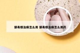 狼毒根治癣怎么用 狼毒根治癣怎么用药