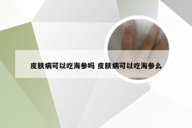 皮肤病可以吃海参吗 皮肤病可以吃海参么