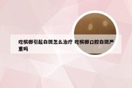 吃槟榔引起白斑怎么治疗 吃槟榔口腔白斑严重吗