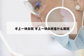 手上一块白斑 手上一块白斑是什么原因