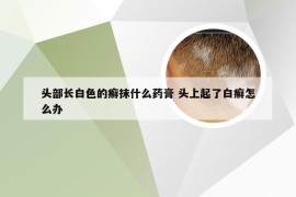 头部长白色的癣抹什么药膏 头上起了白癣怎么办