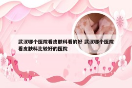 武汉哪个医院看皮肤科看的好 武汉哪个医院看皮肤科比较好的医院