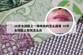 16岁女孩脸上一块块白的怎么回事 16岁女孩脸上有斑怎么办