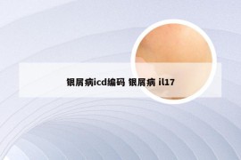 银屑病icd编码 银屑病 il17