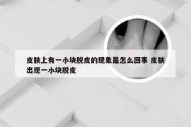 皮肤上有一小块脱皮的现象是怎么回事 皮肤出现一小块脱皮