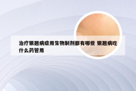 治疗银翘病症用生物制剂都有哪些 银翘病吃什么药管用