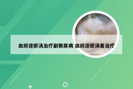 血府逐瘀汤治疗副银屑病 血府逐瘀汤善治疗
