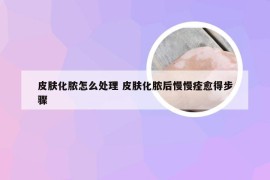 皮肤化脓怎么处理 皮肤化脓后慢慢痊愈得步骤