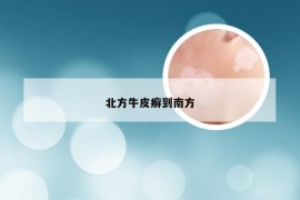 北方牛皮癣到南方