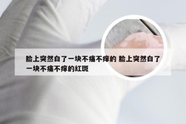 脸上突然白了一块不痛不痒的 脸上突然白了一块不痛不痒的红斑