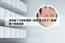 身体起了三四处像癣一样的 身上长了一些像癣一样的皮肤