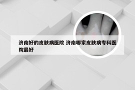 济南好的皮肤病医院 济南哪家皮肤病专科医院最好