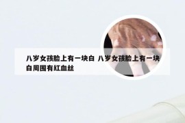 八岁女孩脸上有一块白 八岁女孩脸上有一块白周围有红血丝