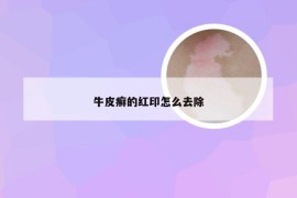 牛皮癣的红印怎么去除