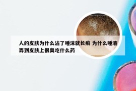 人的皮肤为什么沾了唾沫就长癣 为什么唾液弄到皮肤上很臭吃什么药