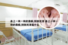 身上一块一块的像癣,特别光滑 身上一块一块的像癣,特别光滑是什么