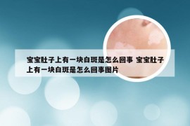 宝宝肚子上有一块白斑是怎么回事 宝宝肚子上有一块白斑是怎么回事图片
