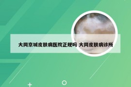 大同京城皮肤病医院正规吗 大同皮肤病诊所