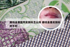 廊坊金盾医院皮肤科怎么样 廊坊金盾皮肤科好不好