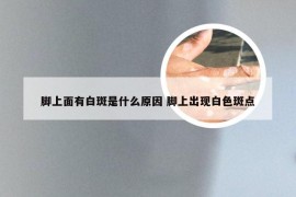 脚上面有白斑是什么原因 脚上出现白色斑点