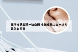 孩子皮肤出现一块白斑 小孩皮肤上白一块儿是怎么回事