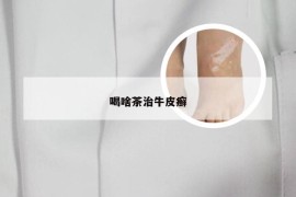喝啥茶治牛皮癣