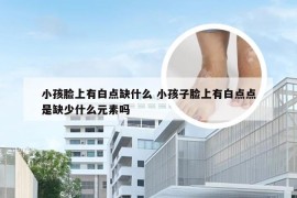 小孩脸上有白点缺什么 小孩子脸上有白点点是缺少什么元素吗