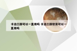 卡泊三醇可以一直用吗 卡泊三醇软膏可以一直用吗