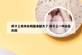 脖子上有块白斑越来越大了 脖子上一块白色的斑