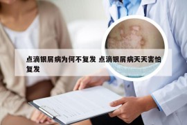 点滴银屑病为何不复发 点滴银屑病天天害怕复发