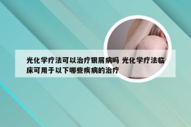 光化学疗法可以治疗银屑病吗 光化学疗法临床可用于以下哪些疾病的治疗