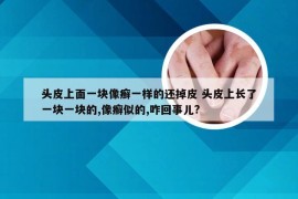 头皮上面一块像癣一样的还掉皮 头皮上长了一块一块的,像癣似的,咋回事儿?