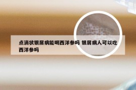 点滴状银屑病能喝西洋参吗 银屑病人可以吃西洋参吗