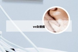 ve白癫疯