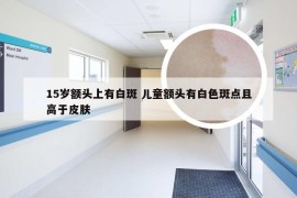 15岁额头上有白斑 儿童额头有白色斑点且高于皮肤