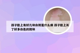孩子脸上有好几块白斑是什么病 孩子脸上长了好多白色的斑块